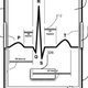 Illustration for article titled Apple Wants Your Heartbeat to Unlock Your iPhone